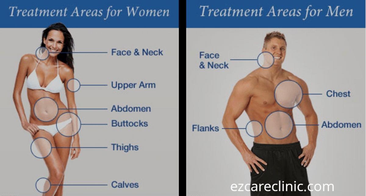 Liposuction areas for women and men- EzCareClinic