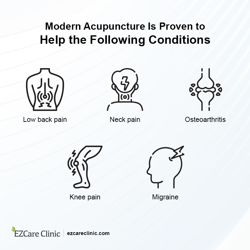Modern Acupuncture Benefits