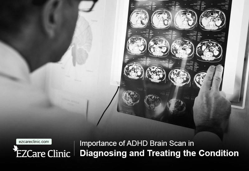 Brain scans for ADHD